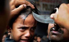 ʲҶ����˹�ִ�ͳ���ף��������ڣ�:Ѫ�ȸ���ͷƤ