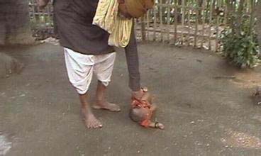 印度又一震惊世界的荒谬奇风异俗:残忍巫医脚踏小孩治其喉咙痛