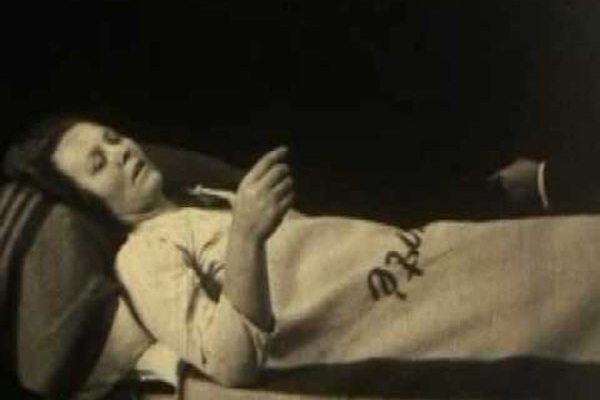 世界上诡异的八种流行怪病--嗜睡性脑炎​(1915-1926)​